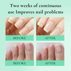 Lozione per riparazioni per unghie nutriente antidegebrato antiello skin shil shishfish olio per unghie per unghie